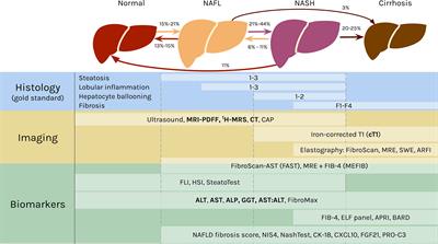 Human Genetics to Identify Therapeutic Targets for NAFLD: Challenges and Opportunities